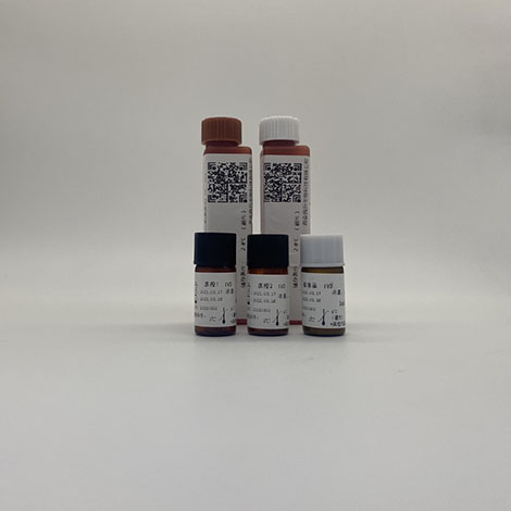 低密度脂蛋白胆固醇（LDL）检测试剂盒（直接法）