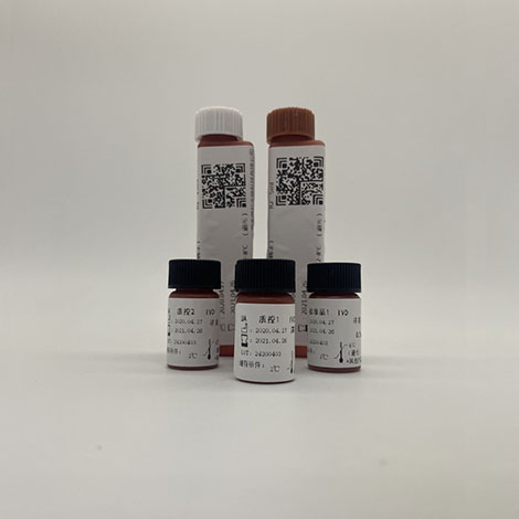 尿酸（UA）检测试剂盒（酶法）