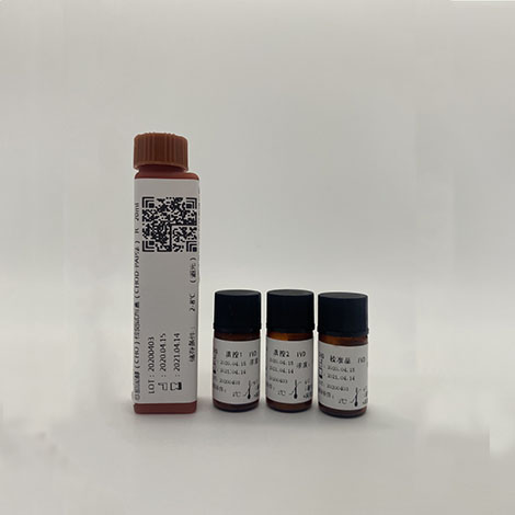 总胆固醇（CHO）检测试剂盒（CHOD-PAP法）